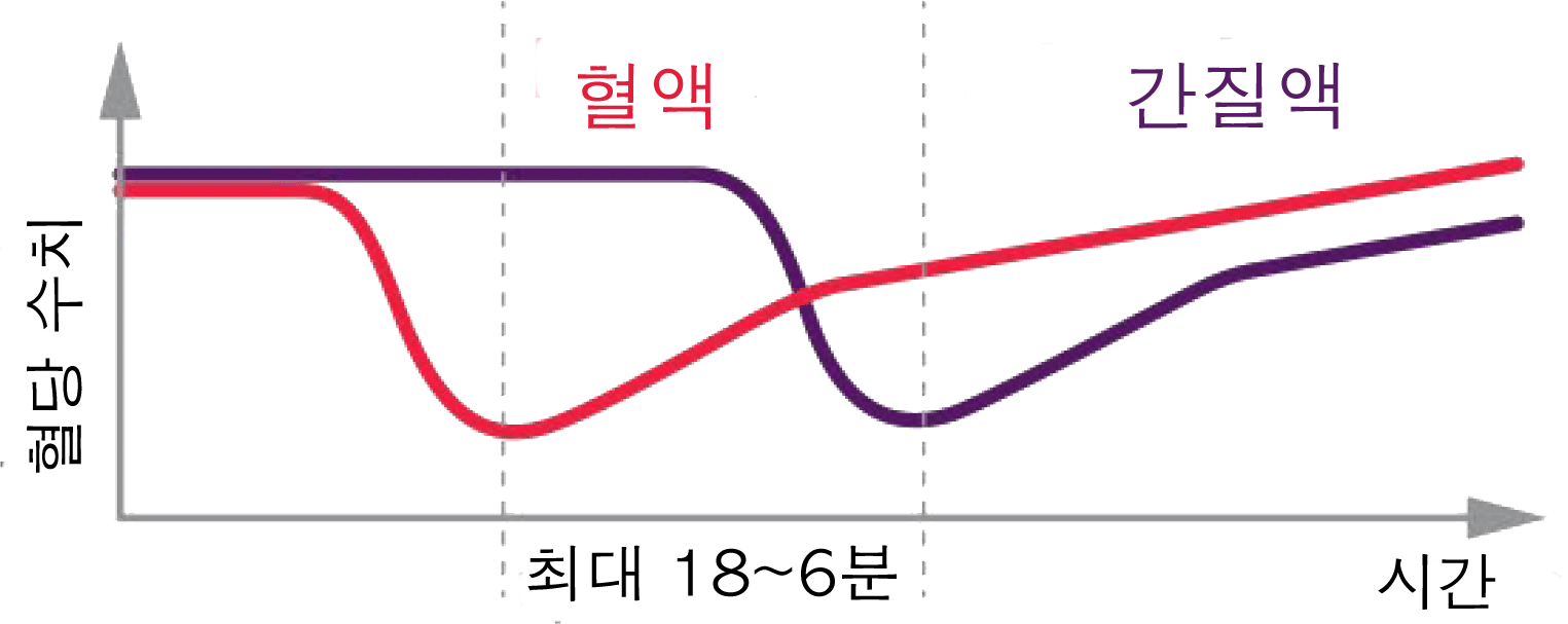 BGM과 CGM의 혈당 수치 측정 간 시간 지연을 보여주는 그림